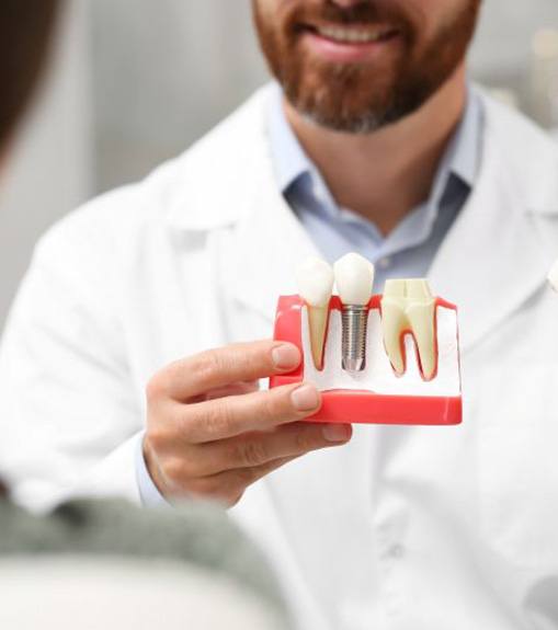 Dentist using model to share information about dental implants
