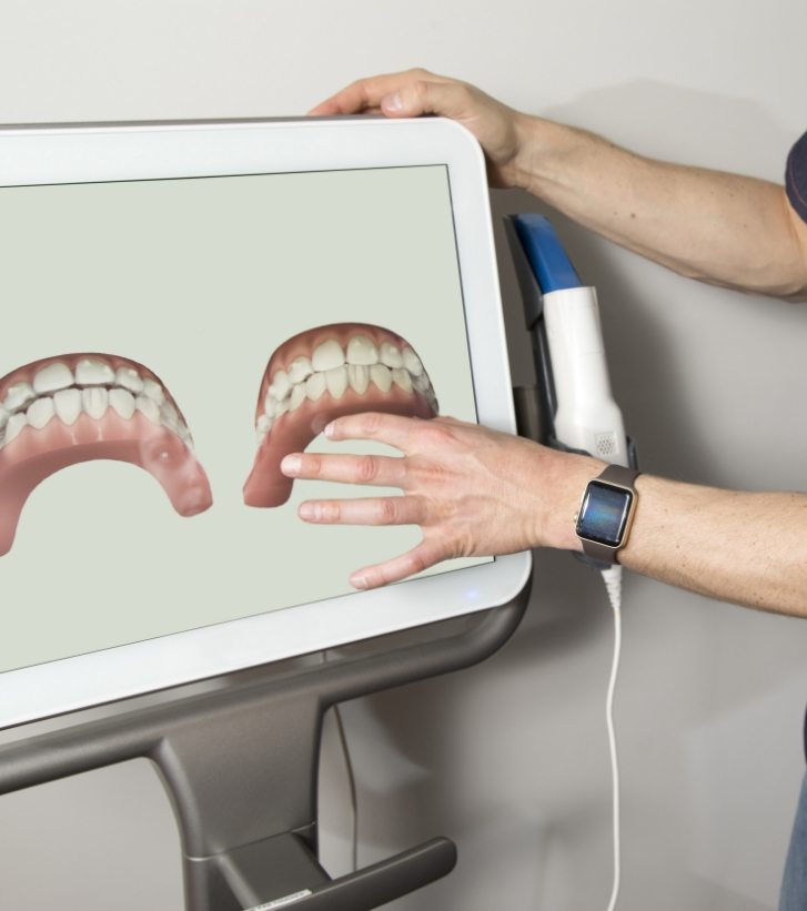 Dentist gesturing to computer monitor showing digital models of row of teeth