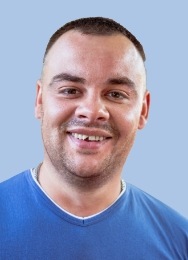 Man in blue shirt smiling with a chipped tooth