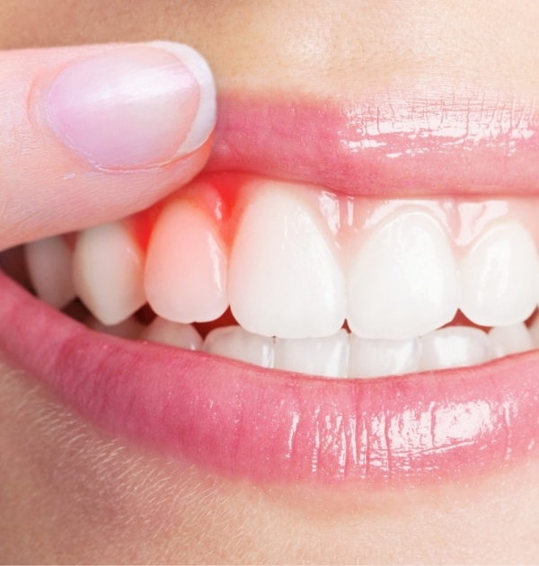 Person pointing to red spot in their gums before gum disease treatment