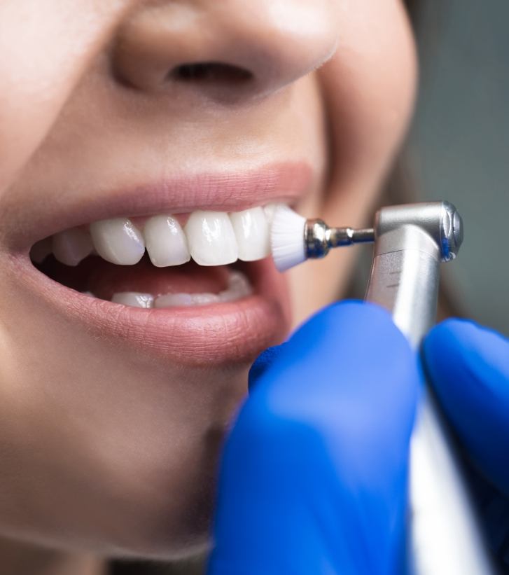 Close up of dental hygienist cleaning a patients teeth