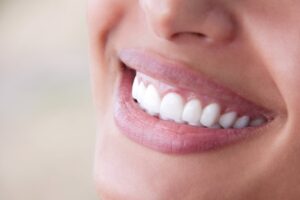 Beautiful smile.
