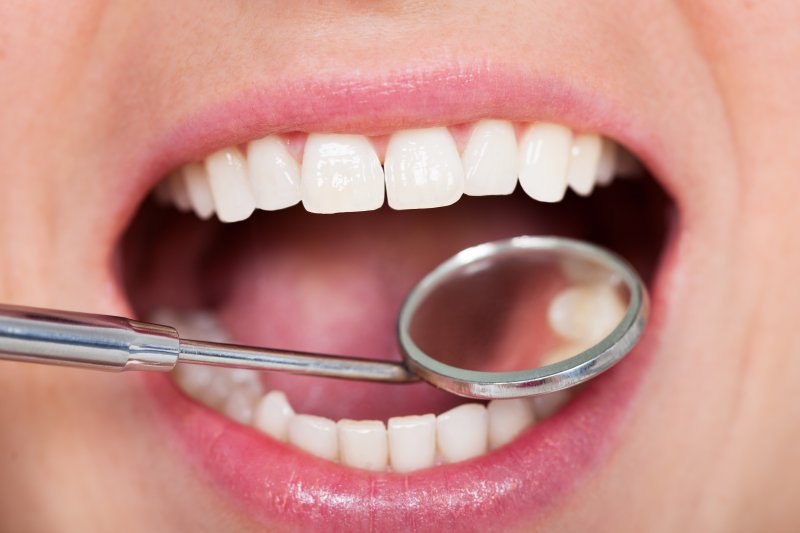 Smile examined with dental mirror